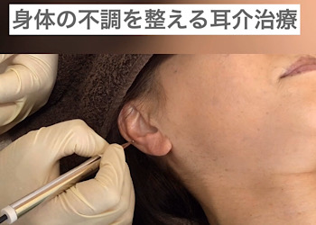 耳介療法